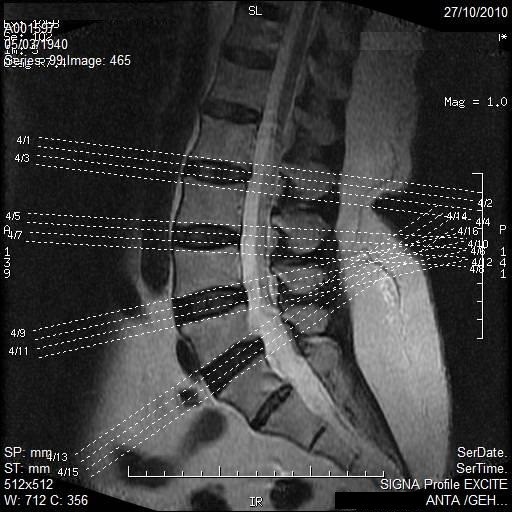 Resonancia magnetica