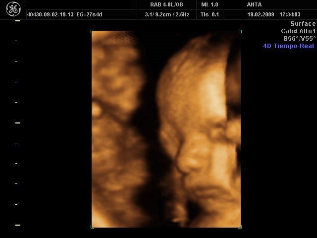 ecografía 4d cara de bebé